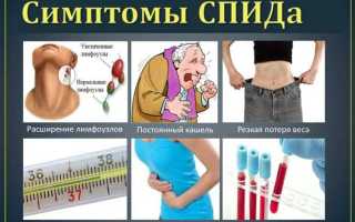 Как узнать что у тебя спид