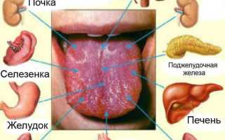 Как избавиться от желтого налета на языке