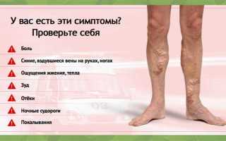 Как лечить трофические язвы на ногах