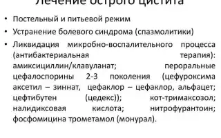 Как лечить острый цистит