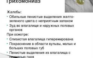 Влагалищные выделения: причины, симптомы и методы лечения