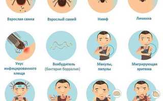 Симптомы боррелиоза