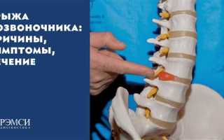 Как эффективно и безопасно лечить позвонковые грыжи: 9 ключевых этапов