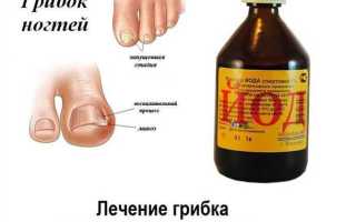 Как избавиться от грибка стопы дома