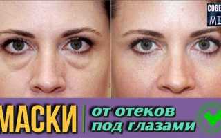 Как избавиться от мешков под глазами в домашних условиях
