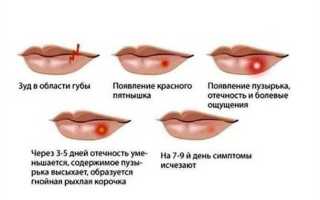 Как лечить болячку на губах
