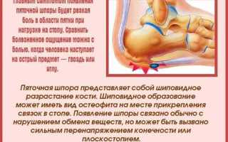 Чем лечить шпоры на пятках