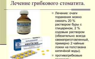 Как вылечить стоматит у детей