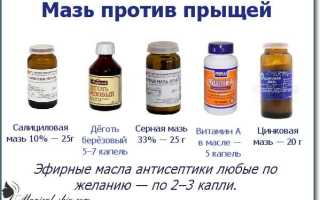 Лечение прыщей в домашних условиях: эффективные методы и рекомендации