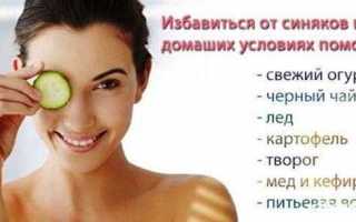 Как избавиться от синяков быстро