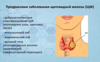 Киста левой доли щитовидной железы, подробности и рекомендации