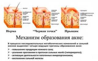 Лечение красных прыщей: простые и эффективные методы
