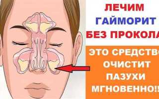 Как избавиться от хронического гайморита