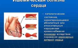 Различные болезни сердца