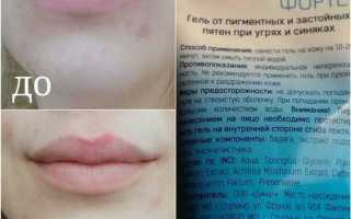 Как убрать следы прыщей на лице