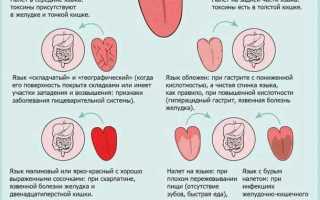Пятно на языке — диагностика и лечение
