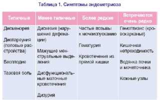 Симптомы эндометриоза