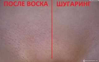 Вариант 1: «Простые способы избавления от раздражения в зоне бикини»