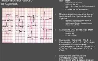 Что такое гипертрофия левого желудочка