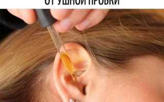 Как лечить серные пробки
