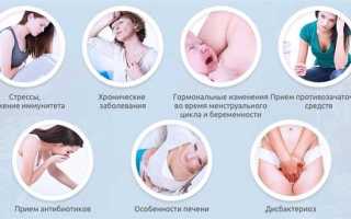 Чем лечить молочницу у беременных