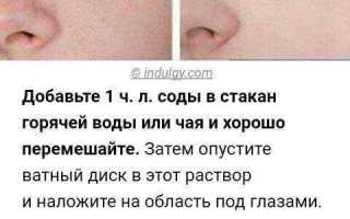 Как избавиться от синяков