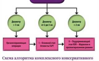 Лекарственные и нехирургические методы лечения миомы матки
