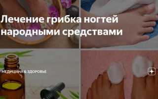 Народные методы лечения микозов