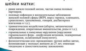 Эрозия шейки матки: причины, симптомы и методы лечения