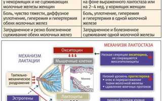 Как избавиться от застоев в груди